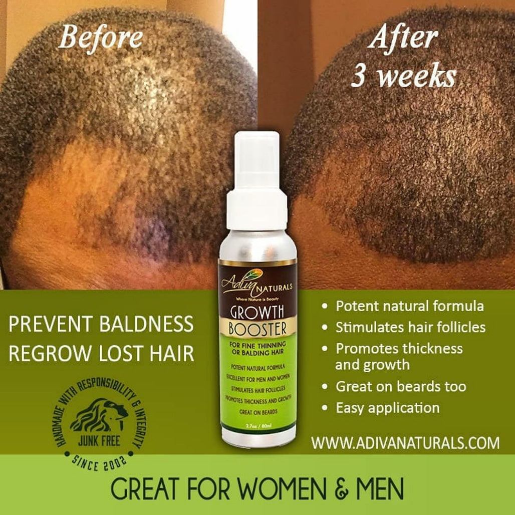 Adiva Naturals Hair Growth Booster | Fine/Balding | Great for Beards