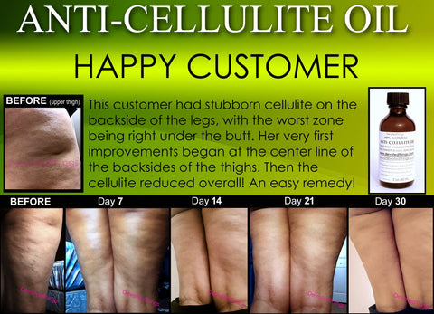 coconut oil cellulite before and after