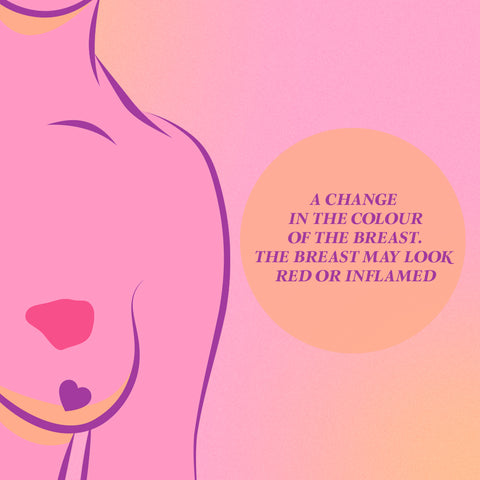breast cancer signs, red inflamed or discolouration