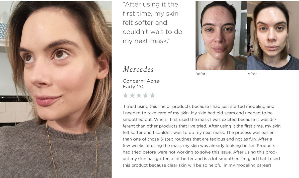 face slimming mask before and after after dark