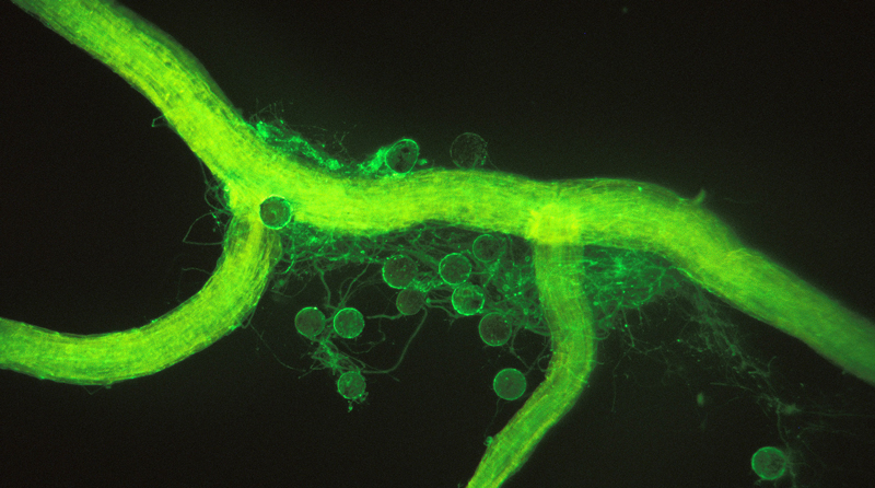 Mycorrhizal fungi and their spores surrounding a plant root.  Photo: Sara Wright/U.S. Department of Agriculture