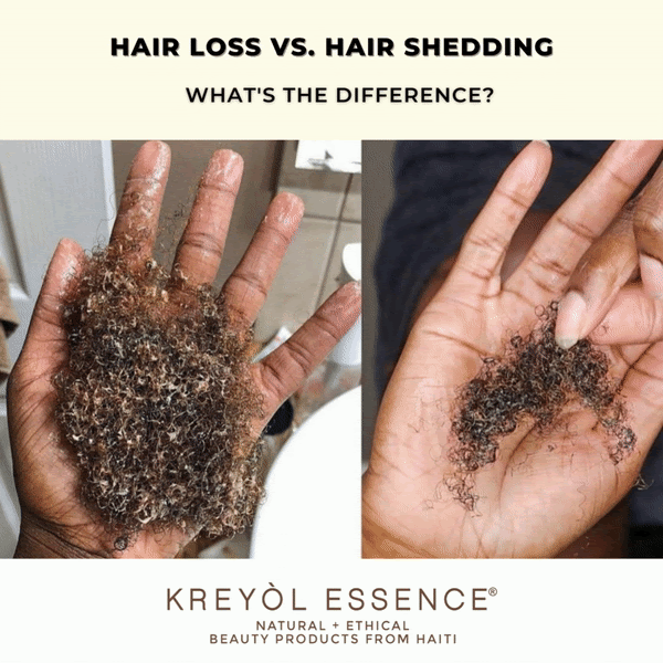 Newsletter: How Much Hair Is Normal To Lose? 🤔 | Kreyòl Essence