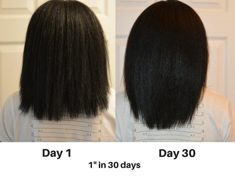 Incredible Hair Growth Shedavi Hair Vitamins Elixir Oil
