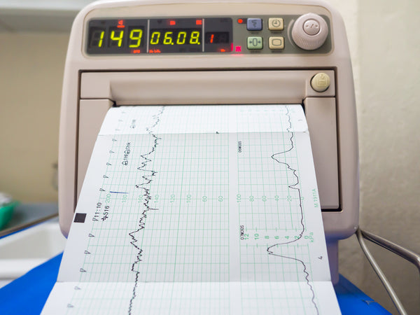 Closeup of a fetal monitor printing baby's heartrate