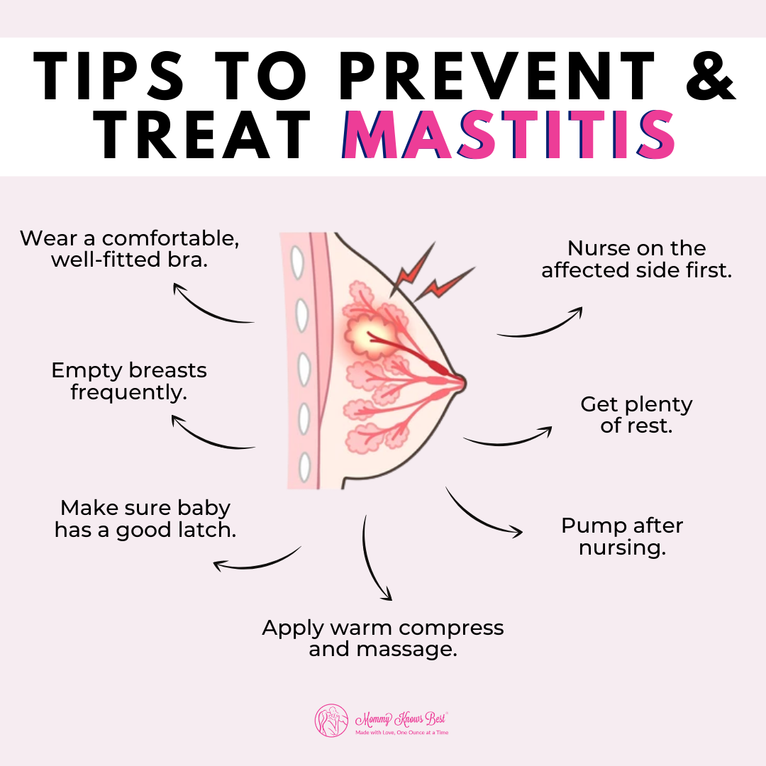 How To Manage AND Prevent Mastitis