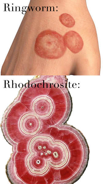 Ringworm vs Rhodochrosite