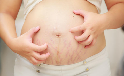 ic: itching during pregnancy