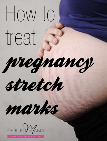 fade-pregnancy-stretch-marks-fast