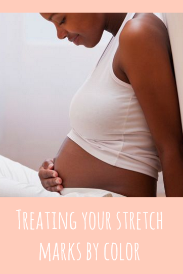 pregnant woman, stretch mark removal, pregnancy stretch marks | The Spoiled Mama, pregnancy skin care