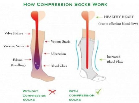  Zipper Compression Socks Toe Open for Varicose Veins and Edema,  Unisex Zip Sox (2 Pack) (Nude, S/M) : Health & Household
