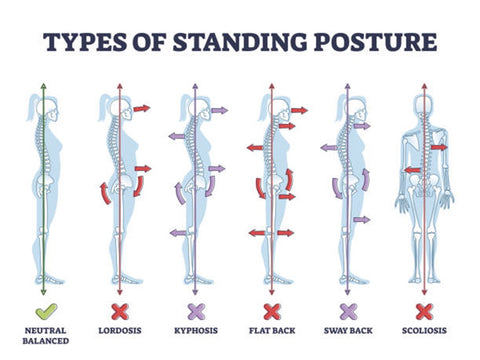 types of posture