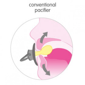 Conventional vs Dentistar pacifier Singapore