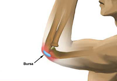 elbow bursing