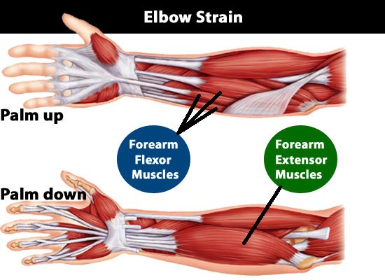 Elbow strain