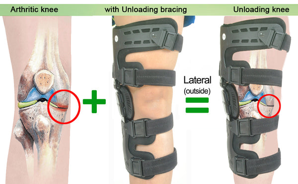 unloader knee brace lateral