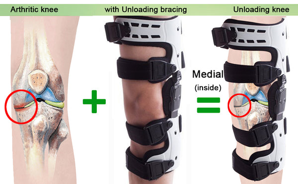 oa unloader knee brace - medial