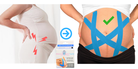 Therapeutic Taping in Pregnancy. Stock Image - Image of female, pregnant:  97346767