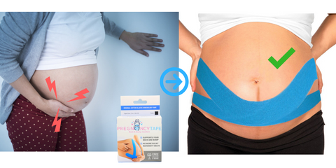  Back & Bump Comfort Pregnancy Tape - Maternity Belly