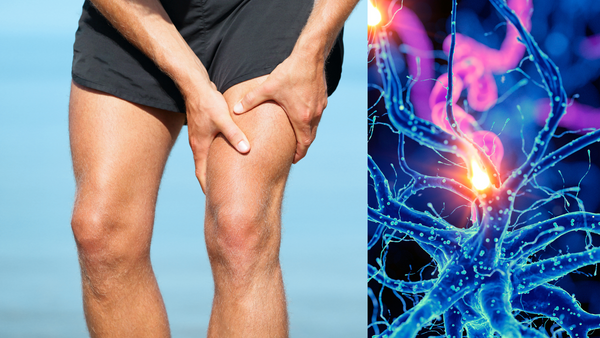 Magnesium Deficient Man Holding leg, excited nerve bundle