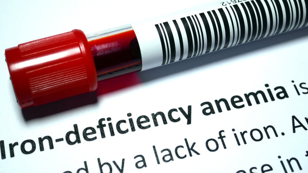 iron deficnecy anemia