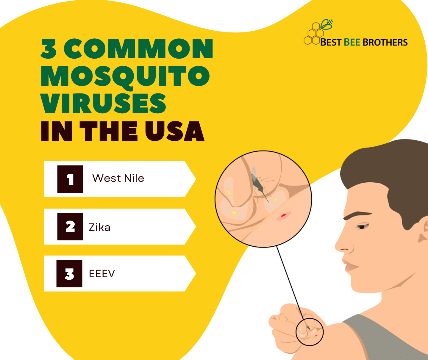 The 3 most common mosquito viruses in the US | Best Bee Brothers
