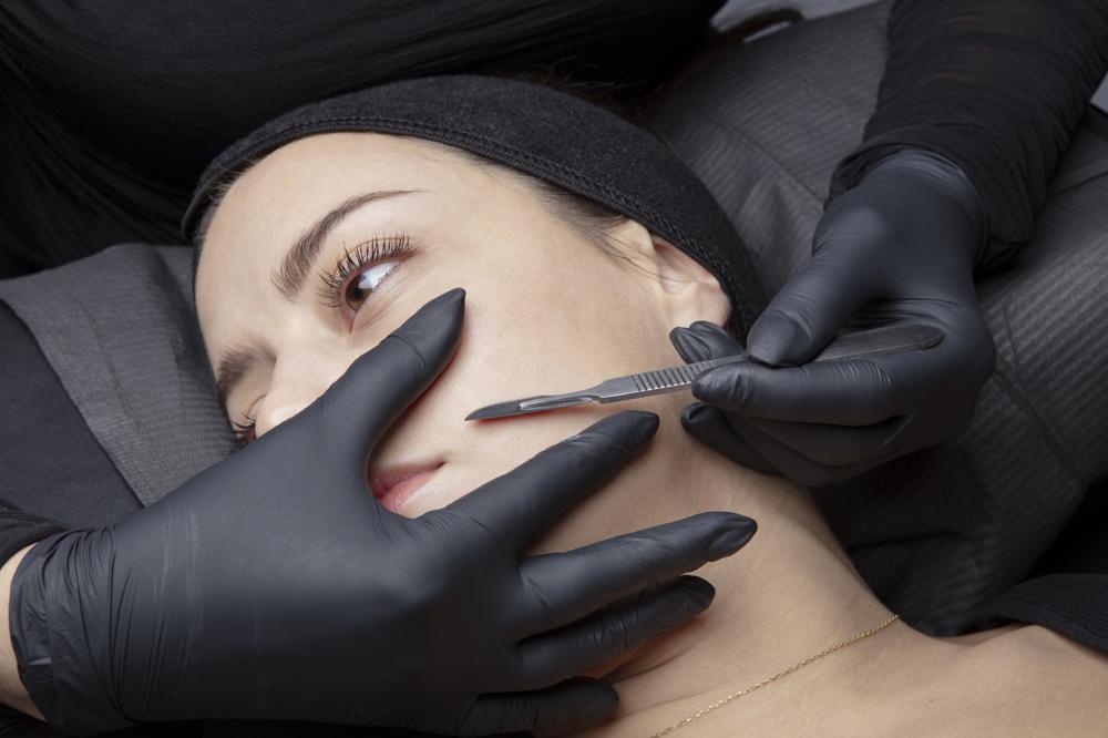 dermaplaning exfoliation facial