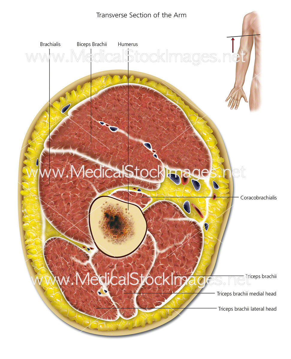 Transverse Section of the Arm - Labelled – Medical Stock Images Company