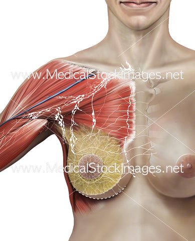 mastectomy node lymph total anatomy relevant surgery during removal some