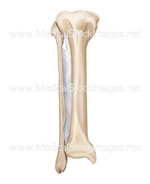 Tibia and Fibula Bones with Interosseous Membrane – Medical Stock