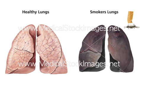 The Respiratory System Stock Images | The Medical Stock Images Company ...