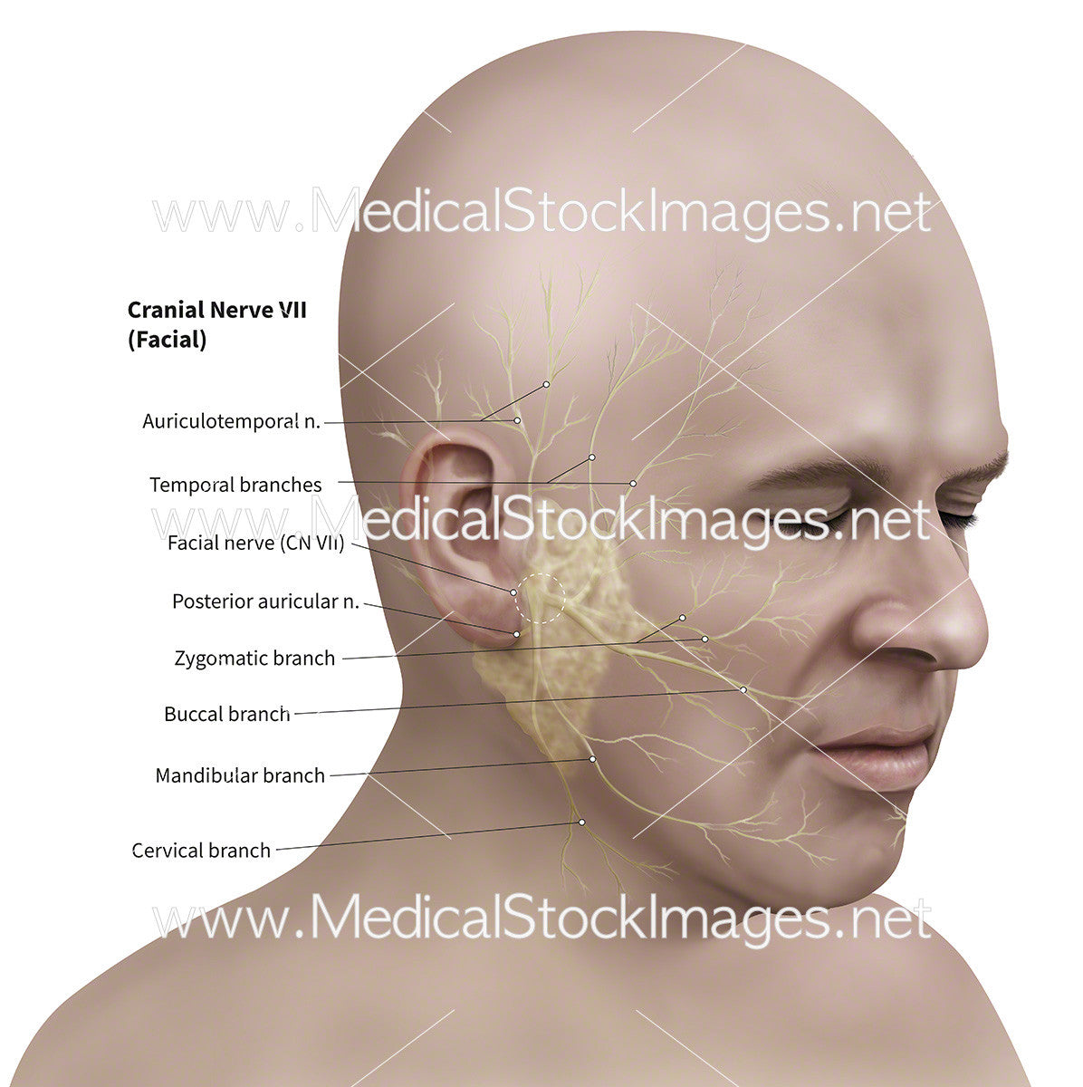 Facial Nerves Affected By Bell S Palsy Labelled Medical Stock Images Company