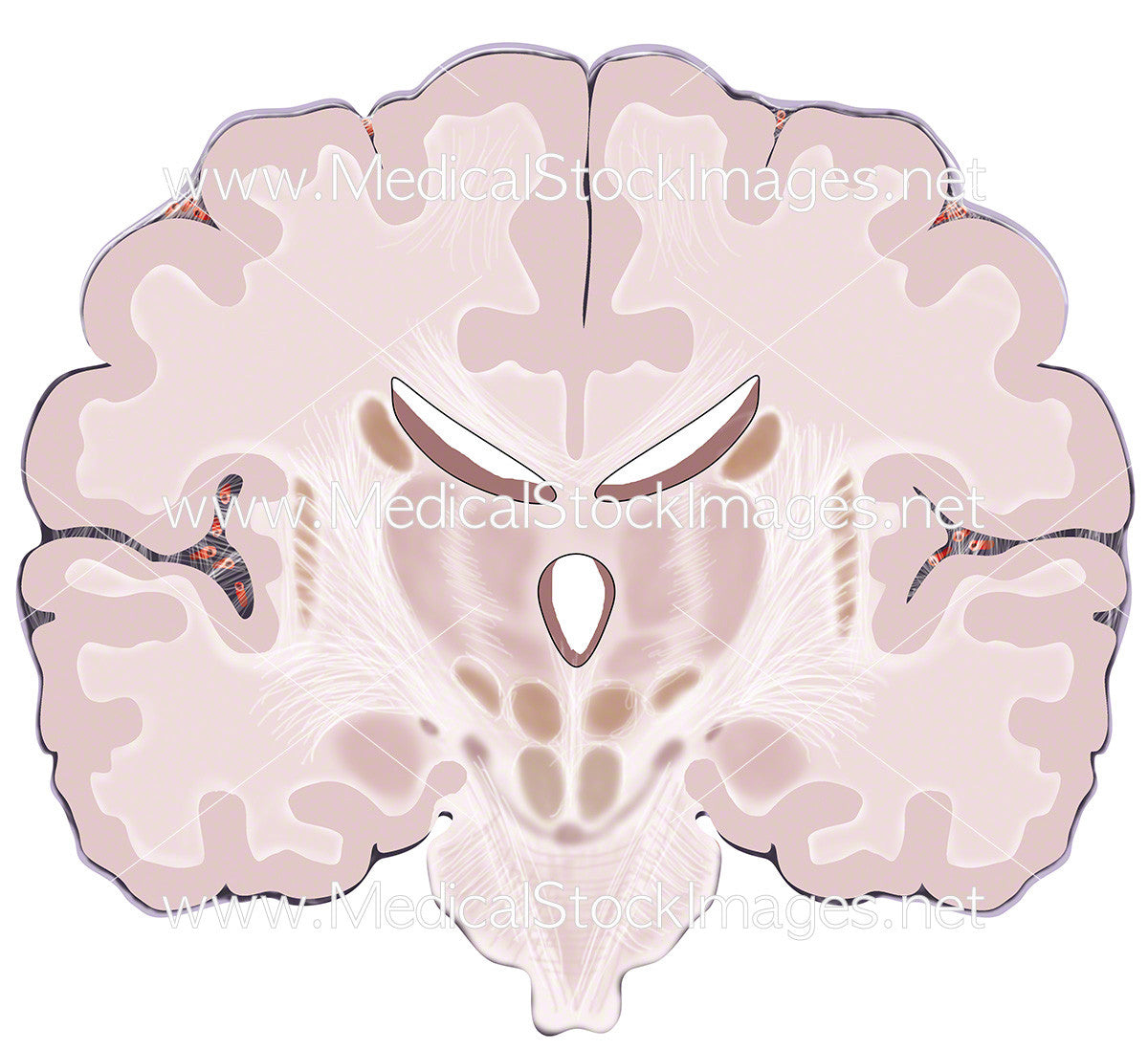 coronal brain