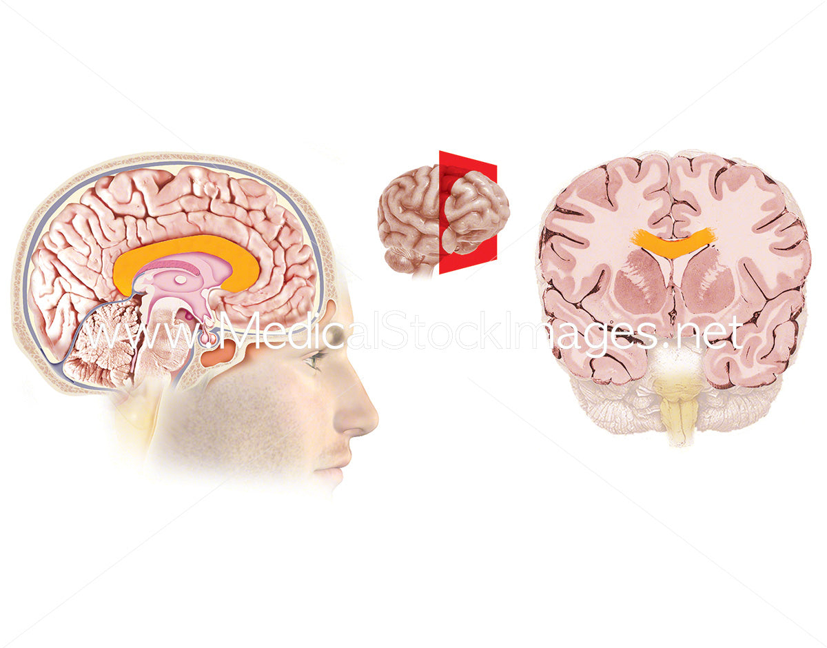 corpus callosum diagram