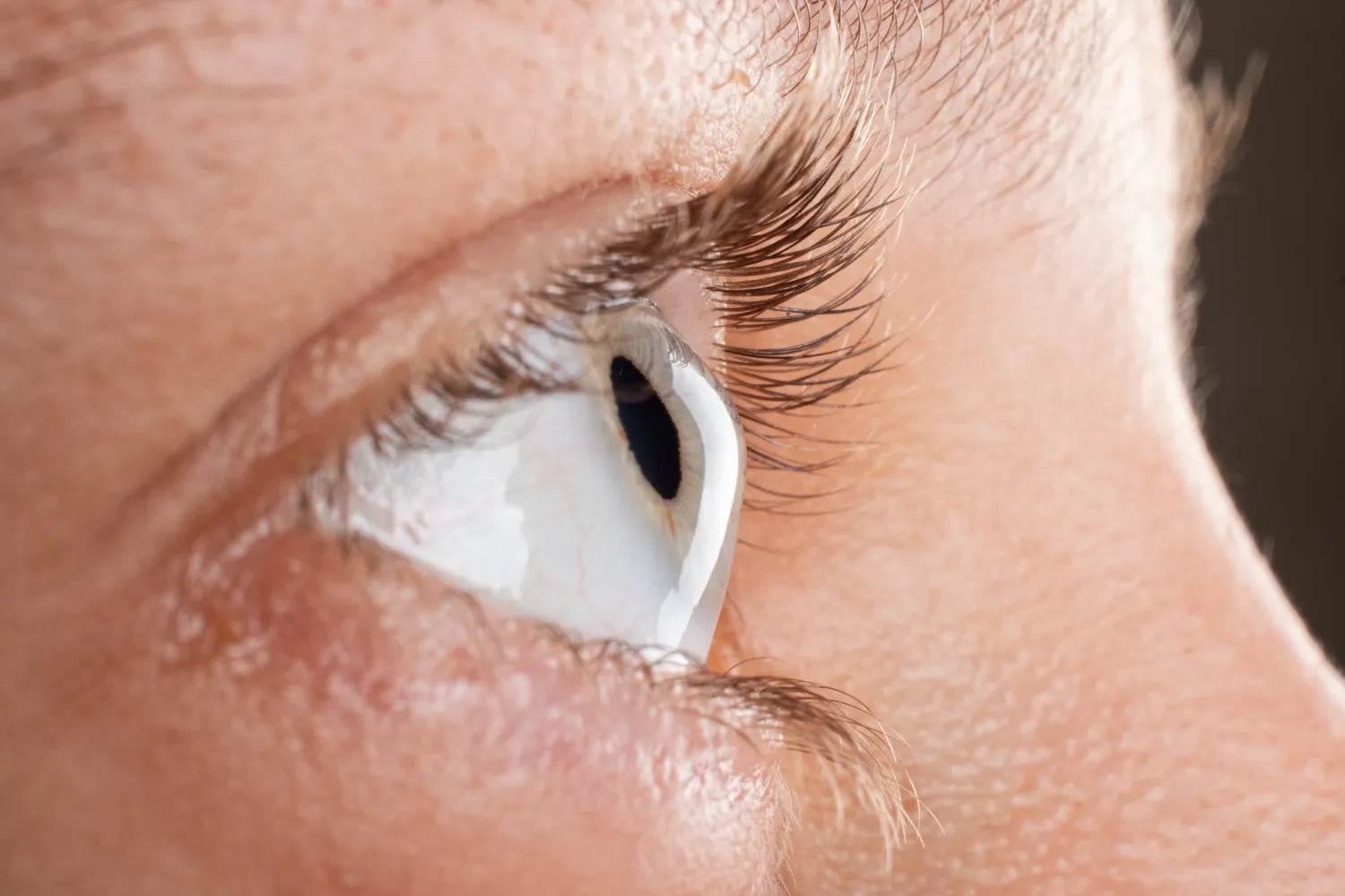 Your Ultimate Guide To Understanding Keratoconus