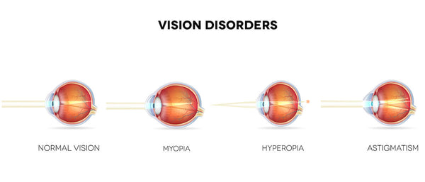 Diagram of vision disorders