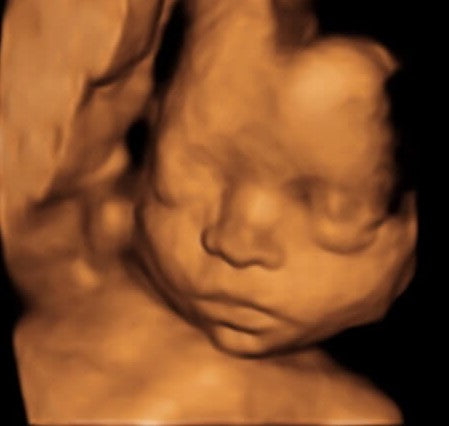 24 weeks pregnant 4d ultrasound