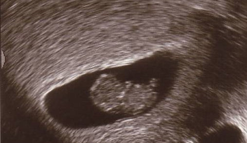 8 week ultrasound