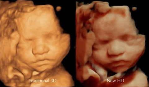 HD LIVE and 3D Scan image