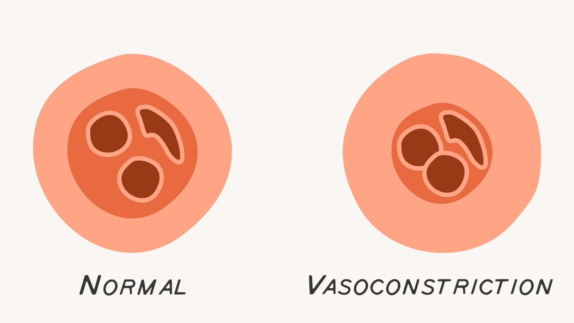 Vasoconstriction