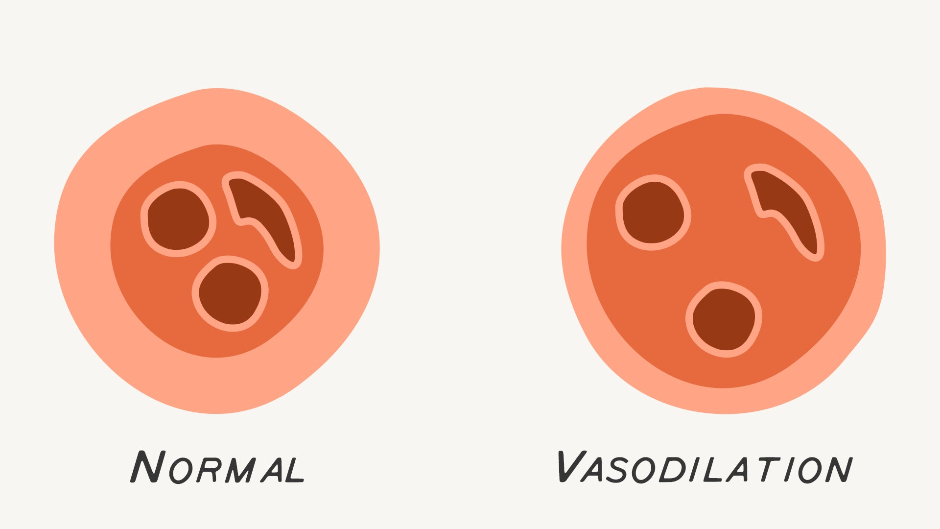 Vasodilation