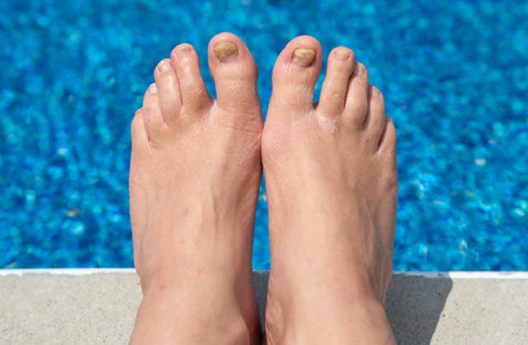 Aging Feet: Natural Changes and Care 02