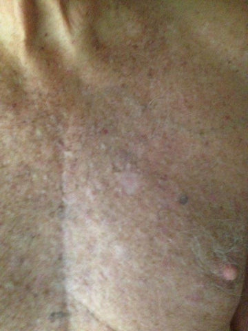 5 day chest