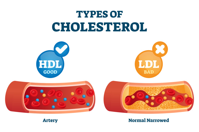 types of cholesterol