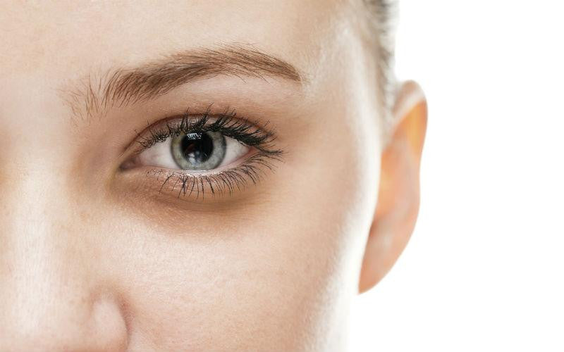 How To Reduce Dark Circles Puffiness And Fine Lines Around Your Eyes