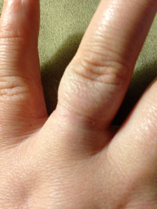 Finger indented from small ring