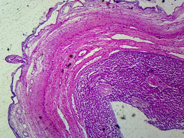 GSC International PS0198 Gallbladder, Human; Showing Simple Columnar E ...