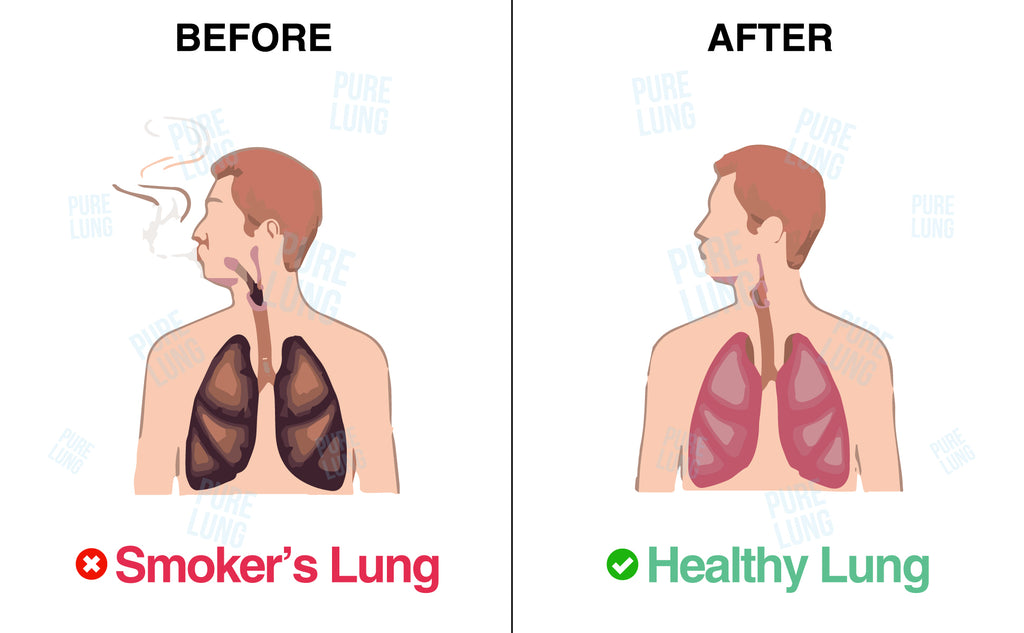 Smoker lung vs Healthy Lung