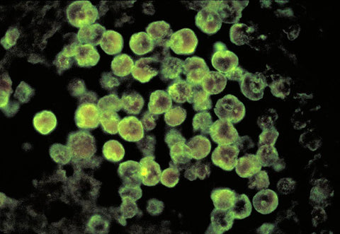 Brain-Eating Amoeba Found in Texas City's Water Supply