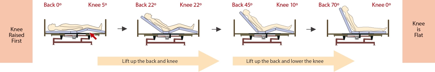 miolet III interlocking motion