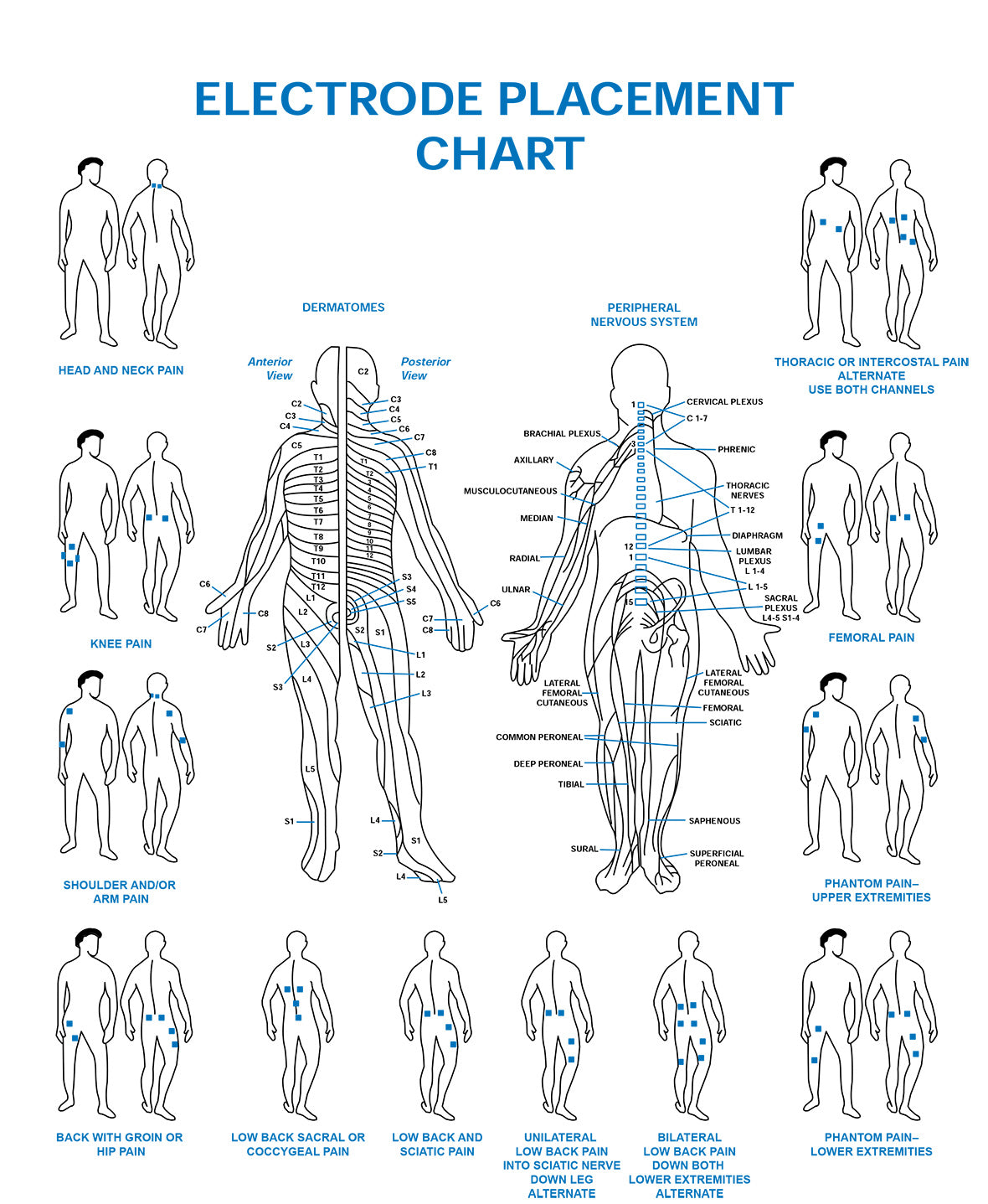 Electrode Placement Chart